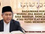 01ips